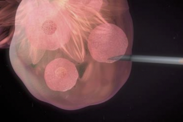 מחקר ענק מסיר את העננה מעל טיפולי הפוריות: אינם גורמים לסרטן השד